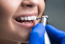Teeth Cleaning and Polishing Benefits